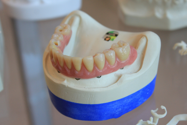 Dentures prosthetic theeth designed to replace missing teeth and restore the natural appearance