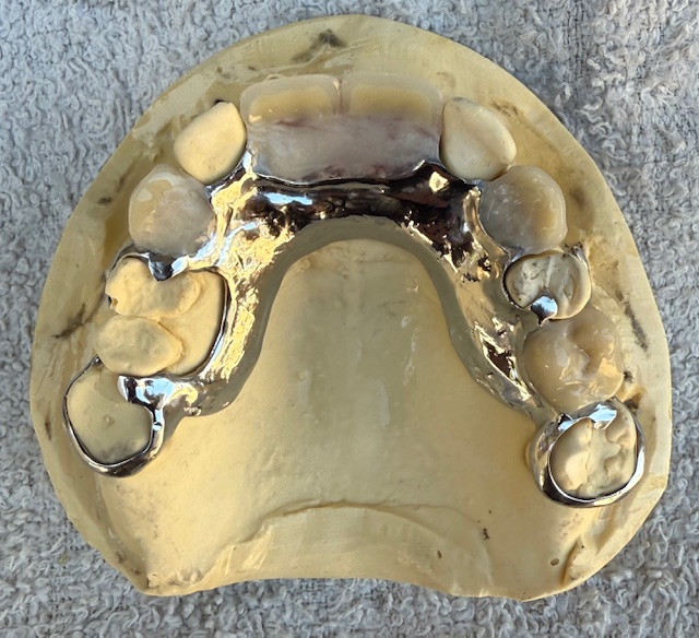 C/C 5 TOOTH DENTURE
