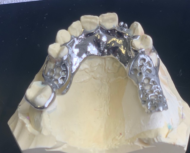 C/C 6 TOOTH DENTURE