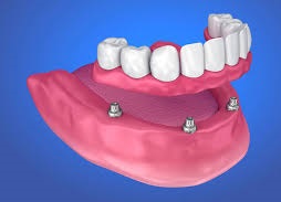 Image d